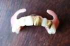VIT Ancien Dentier Fausse Dent Prothèse avec 2 dents en OR 
